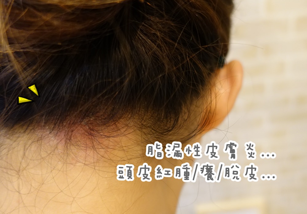 【Hair】頭皮敏感的困擾請交給藥師研發的 decent rossi 地森羅西潔髮蜜粉(天然成分無矽靈)