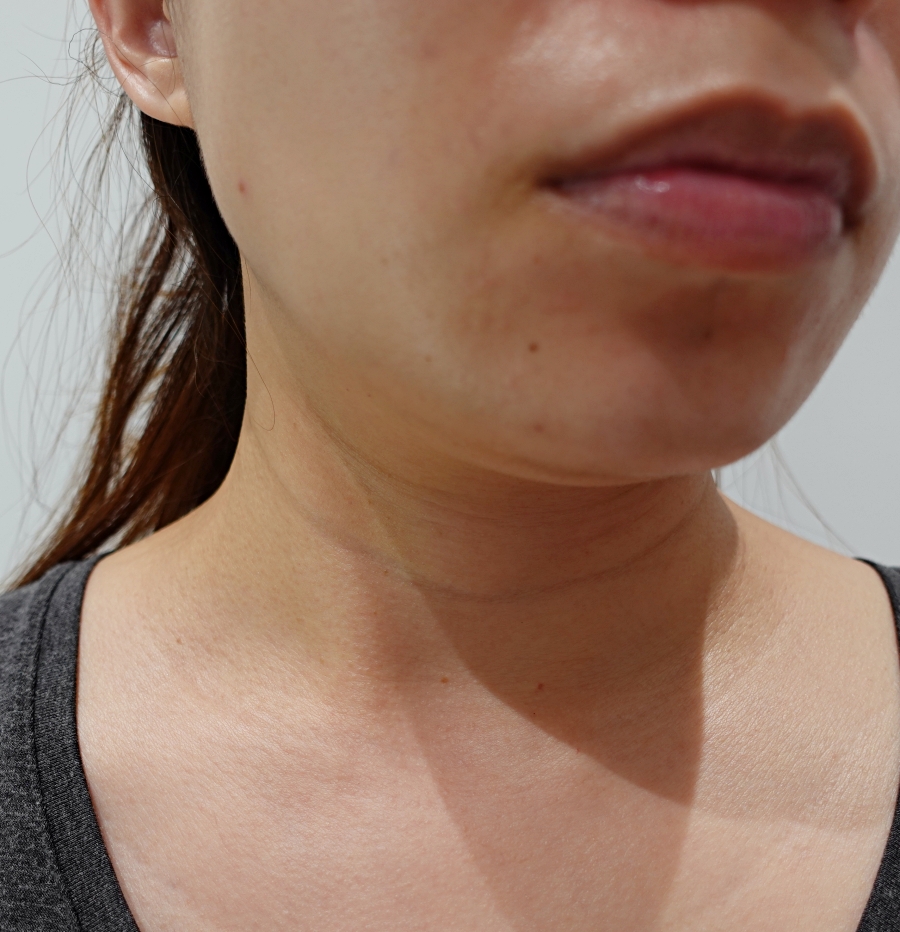 StriVectin團購美國皺效奇蹟心得分享，沒有擦頸霜的脖紋超明顯很顯老看得出歲月痕跡