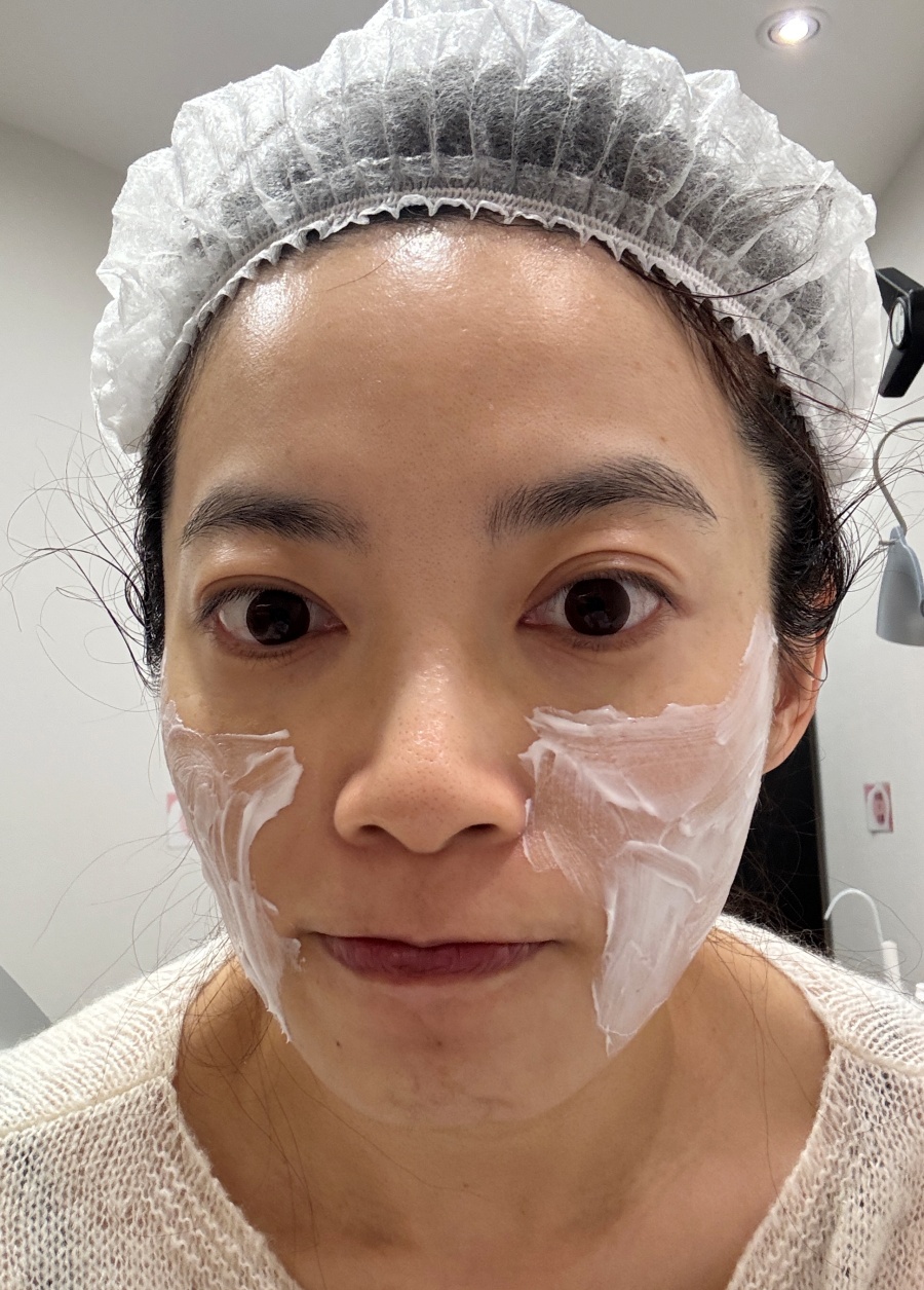 【醫美】怕痛人的索夫波真實心得-琢美妍時尚診所 【醫美】怕痛人的索夫波真實心得-琢美妍時尚診所