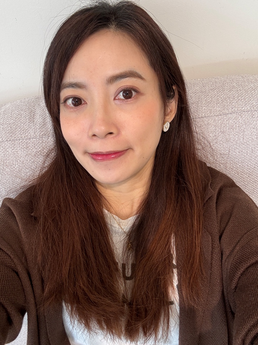 【醫美】怕痛人的索夫波真實心得-琢美妍時尚診所 索夫波施打完兩週