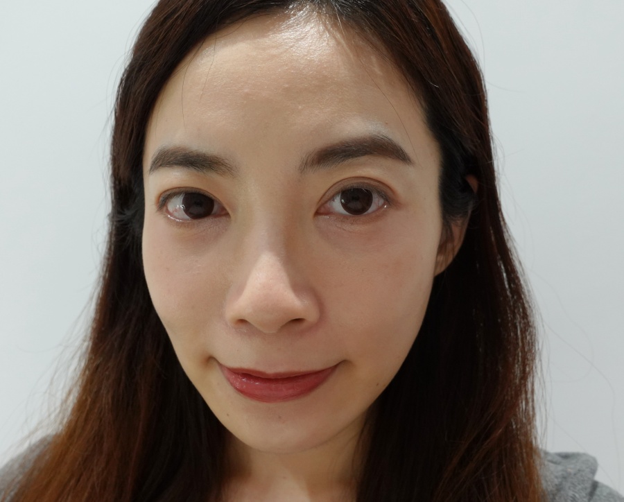 【醫美】怕痛人的索夫波真實心得-琢美妍時尚診所 琢美妍時尚診所索夫波施打完第三週