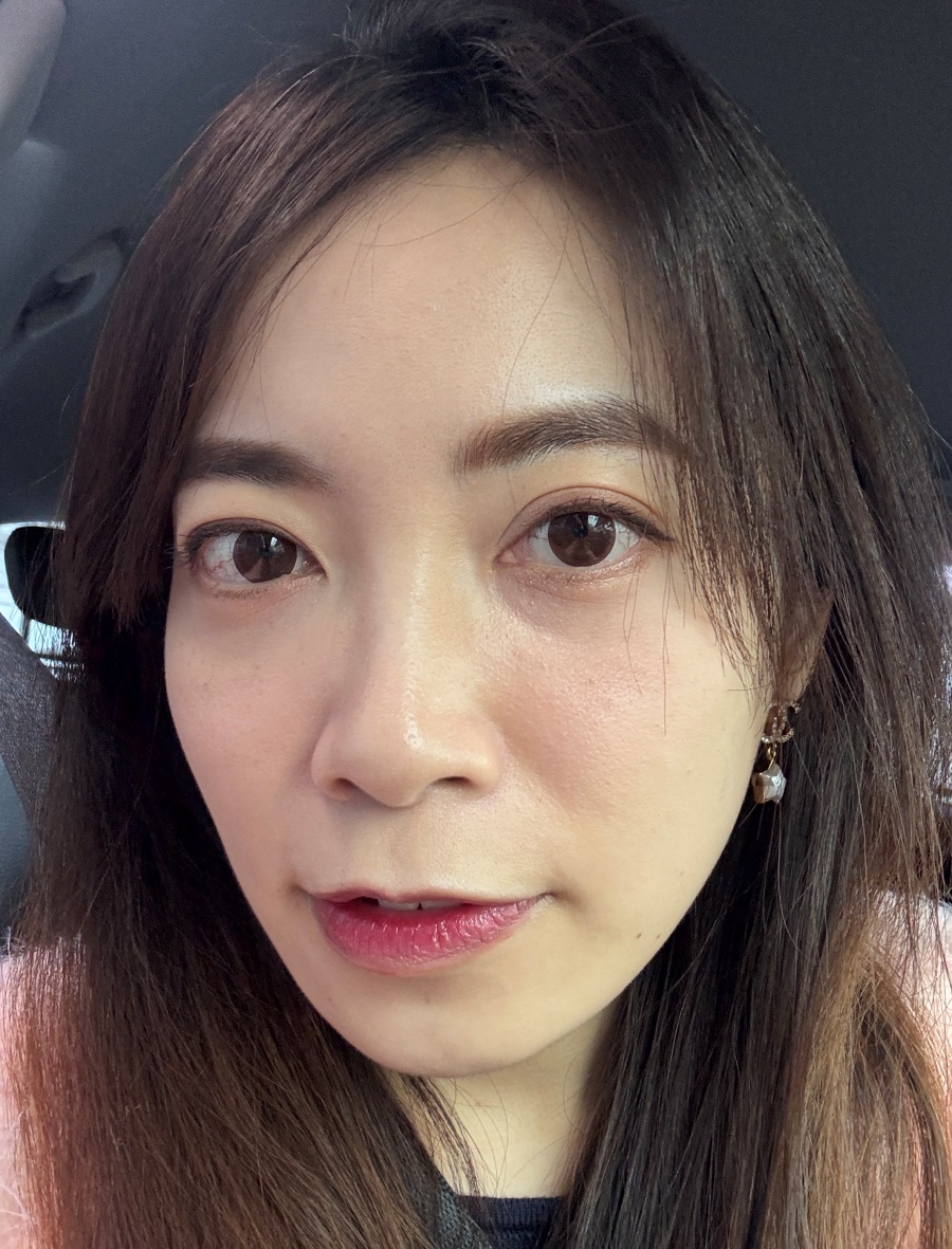 【醫美】怕痛人的索夫波真實心得-琢美妍時尚診所 【醫美】怕痛人的索夫波真實心得-琢美妍時尚診所