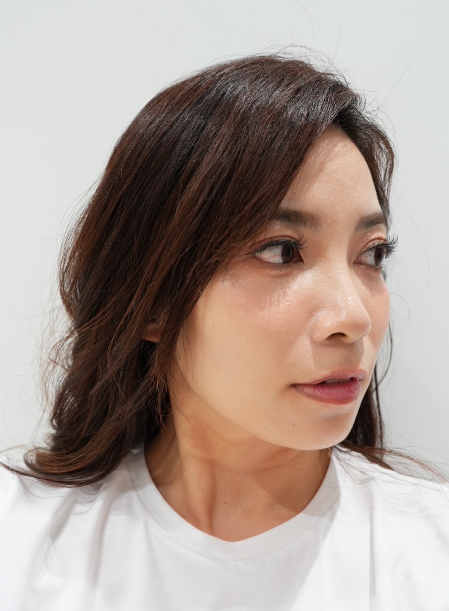 【醫美】怕痛人的索夫波真實心得-琢美妍時尚診所 索夫波四週後