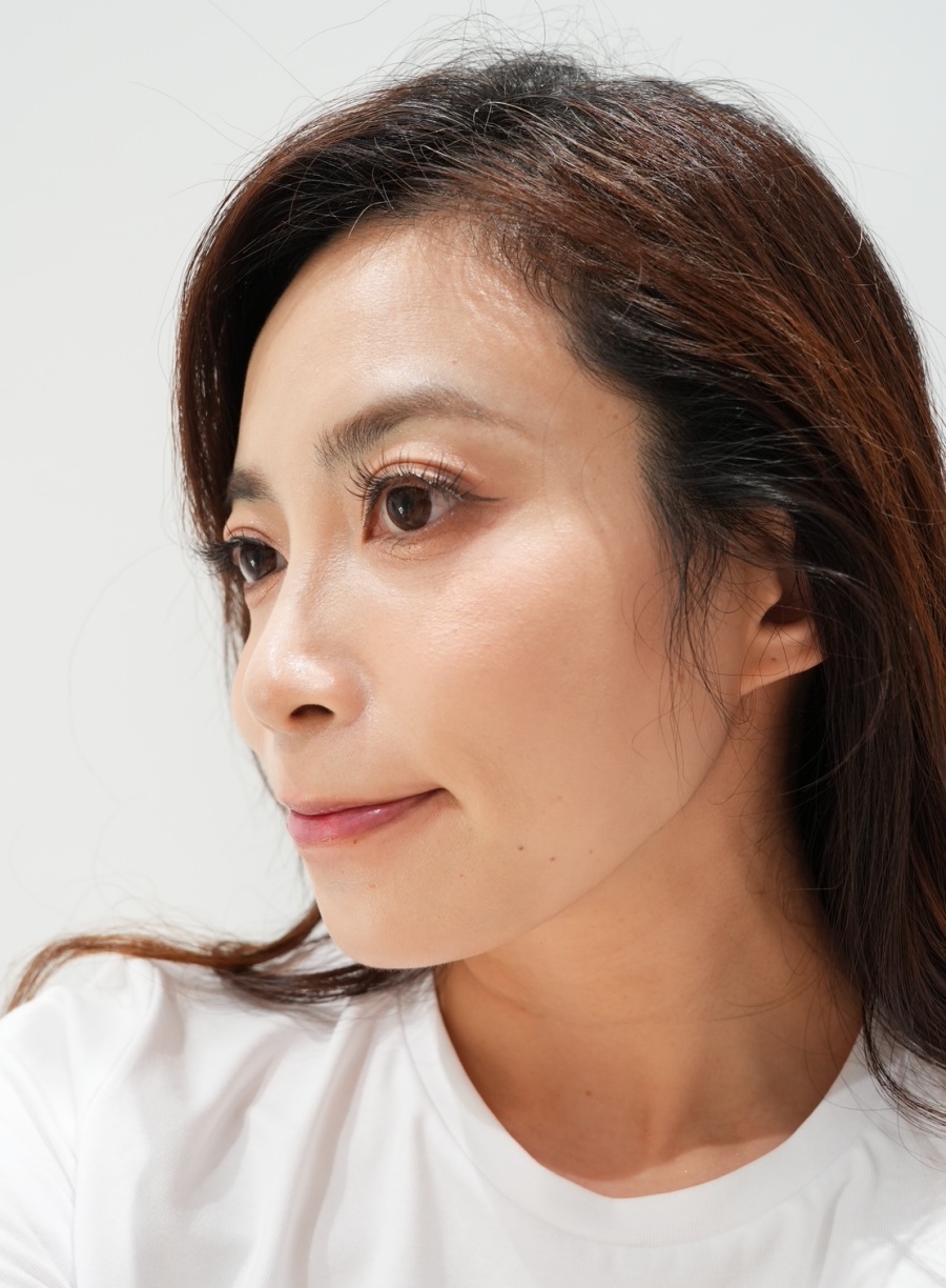 【醫美】怕痛人的索夫波真實心得-琢美妍時尚診所 索夫波施打完一個月後效果