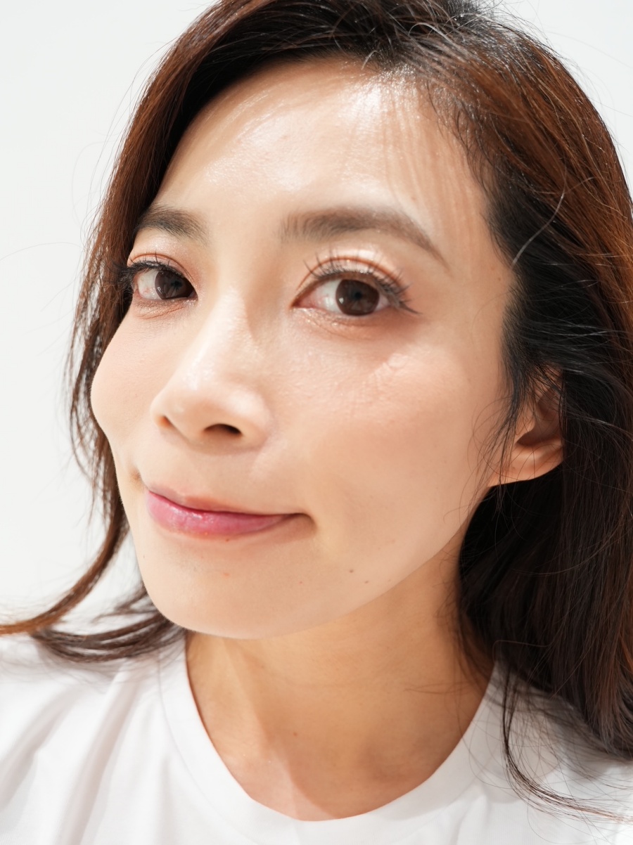【醫美】怕痛人的索夫波真實心得-琢美妍時尚診所 索夫波一個月後